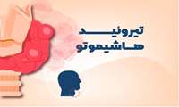 عضو هیات علمی دانشگاه : علایم یک بیماری خودایمنی شایع بر اثر اختلالات تیروئیدی را بشناسید 